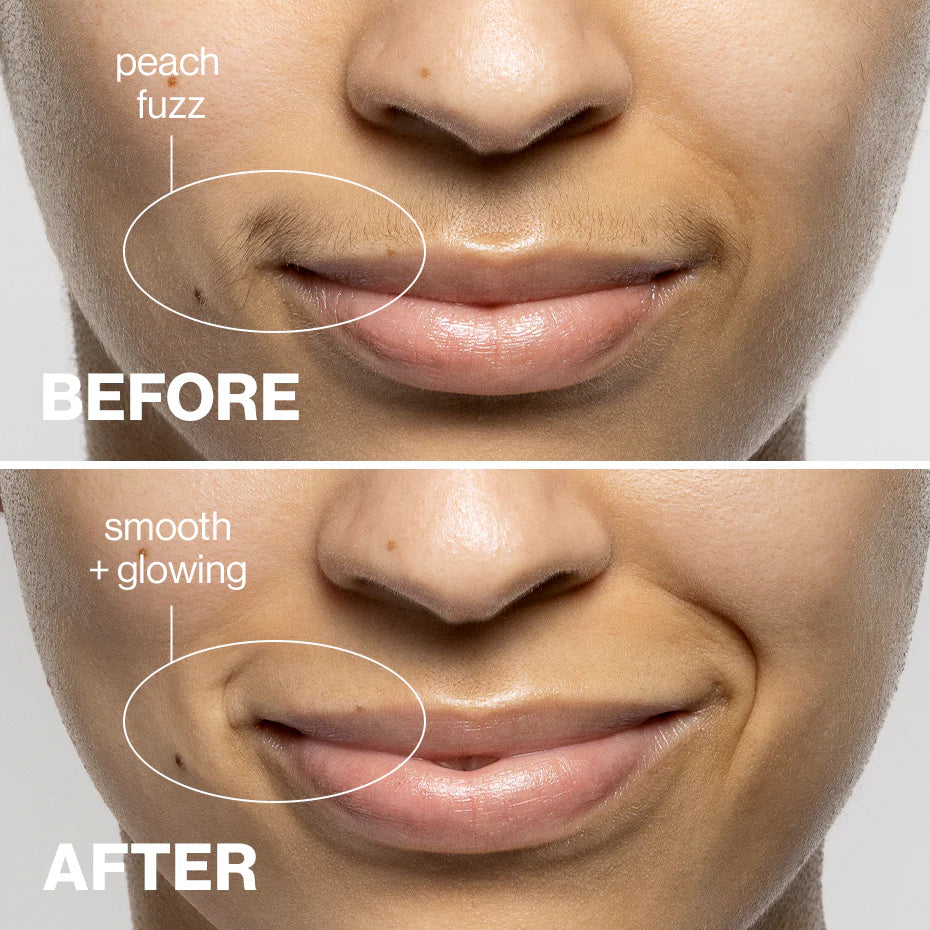 The Face Dermaplaner