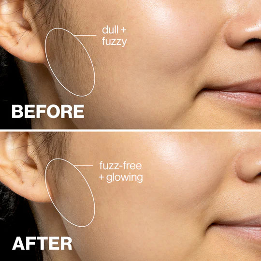 The Face Dermaplaner